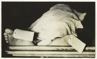 El cuerpo de John Dillinger, atracador de bancos, en una morgue de Chicago, 1934.