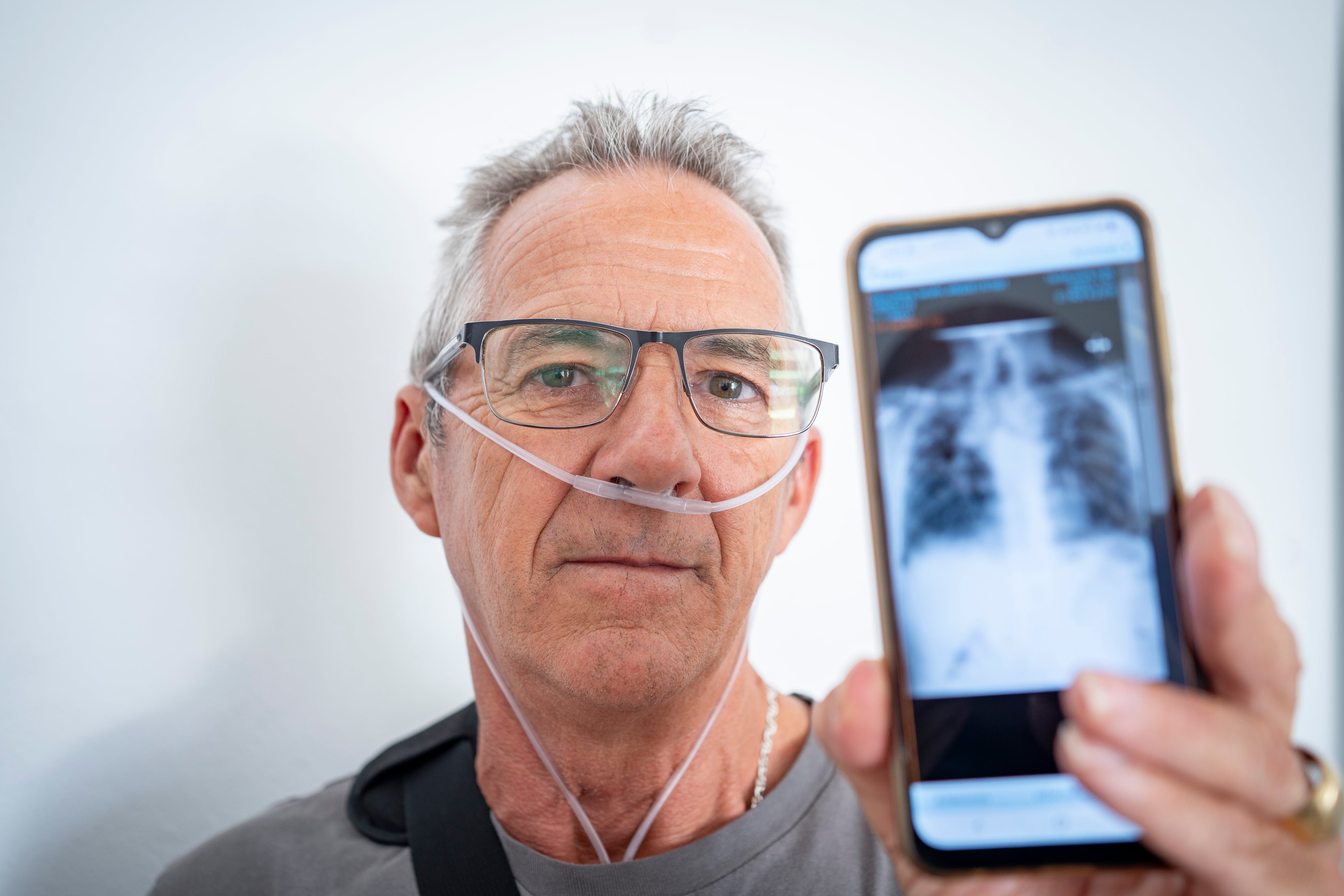 Los casos de silicosis crecen y Trabajo multiplica por cinco las multas a empresas: “Me falta el aire”