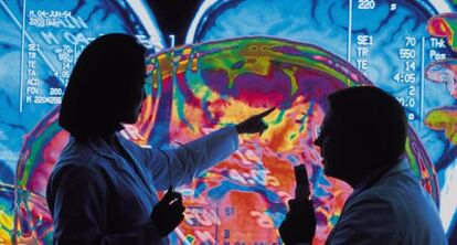 Físcios analizan una imagen escaneada de un cerebro.