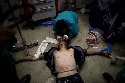Un sanitario atiende a un herido en los bombardeos de Israel de este lunes, en el hospital Nasser de Jan Yunis.