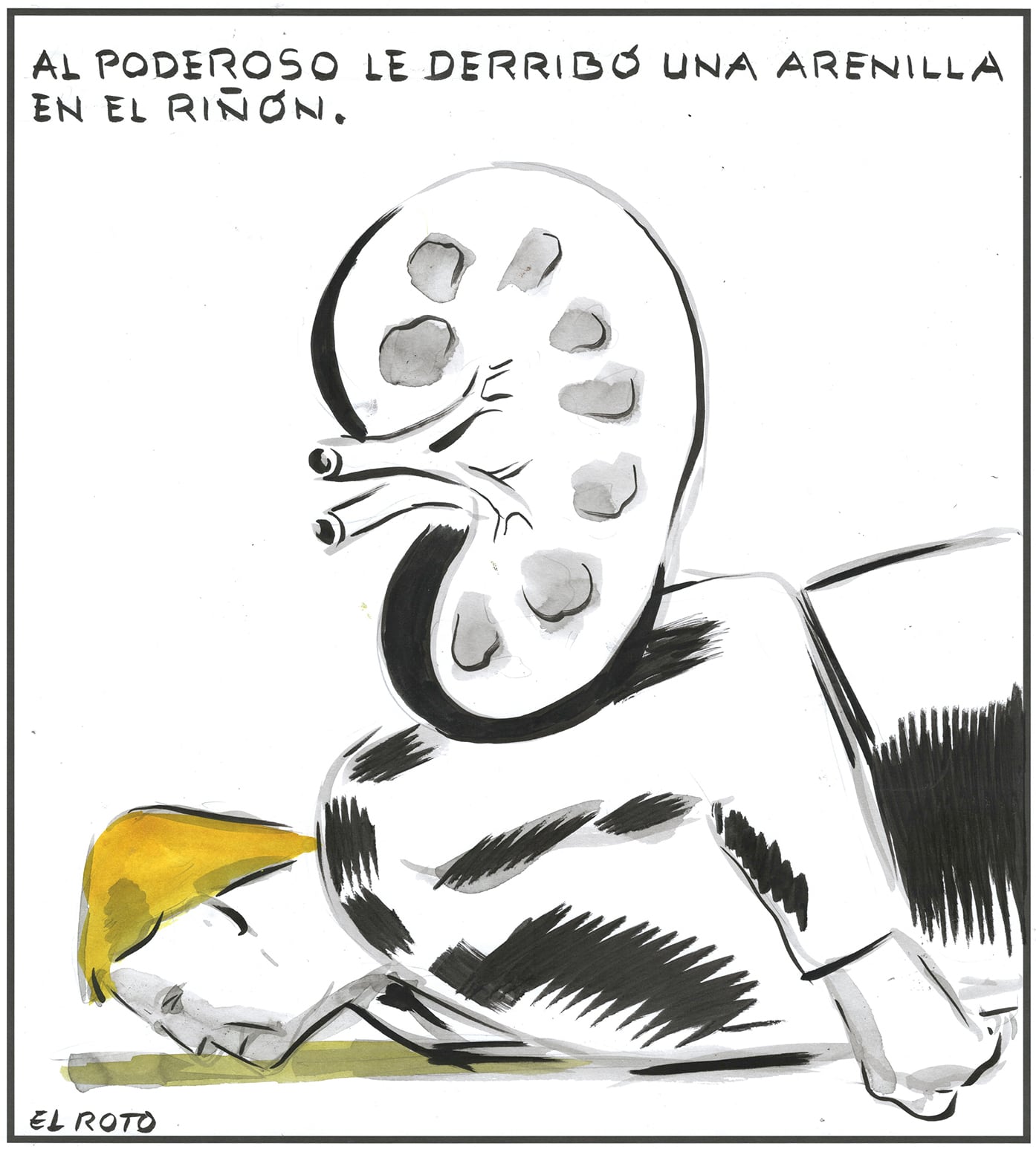 El Roto: el riñón del poderoso