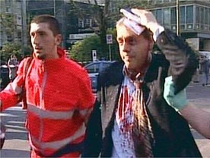 Imagen de televisión de uno de los heridos en el accidente contra el edificio del Gobierno regionel en Milán.