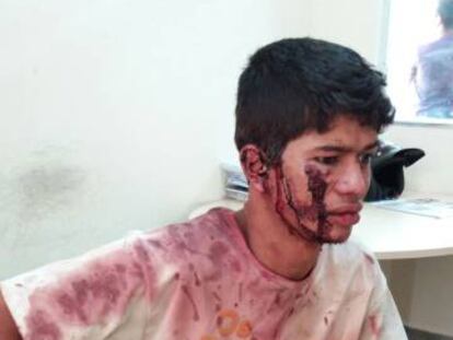 Fazendeiros acusam seguranças da Vale de agressão em área de litígio no Pará