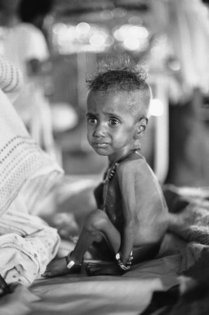 Un niño eritreo en una tienda de campaña médica en el campo de refugiados de Wad Sherife, en Sudán, cerca de la frontera con Etiopía, a principios de 1985.