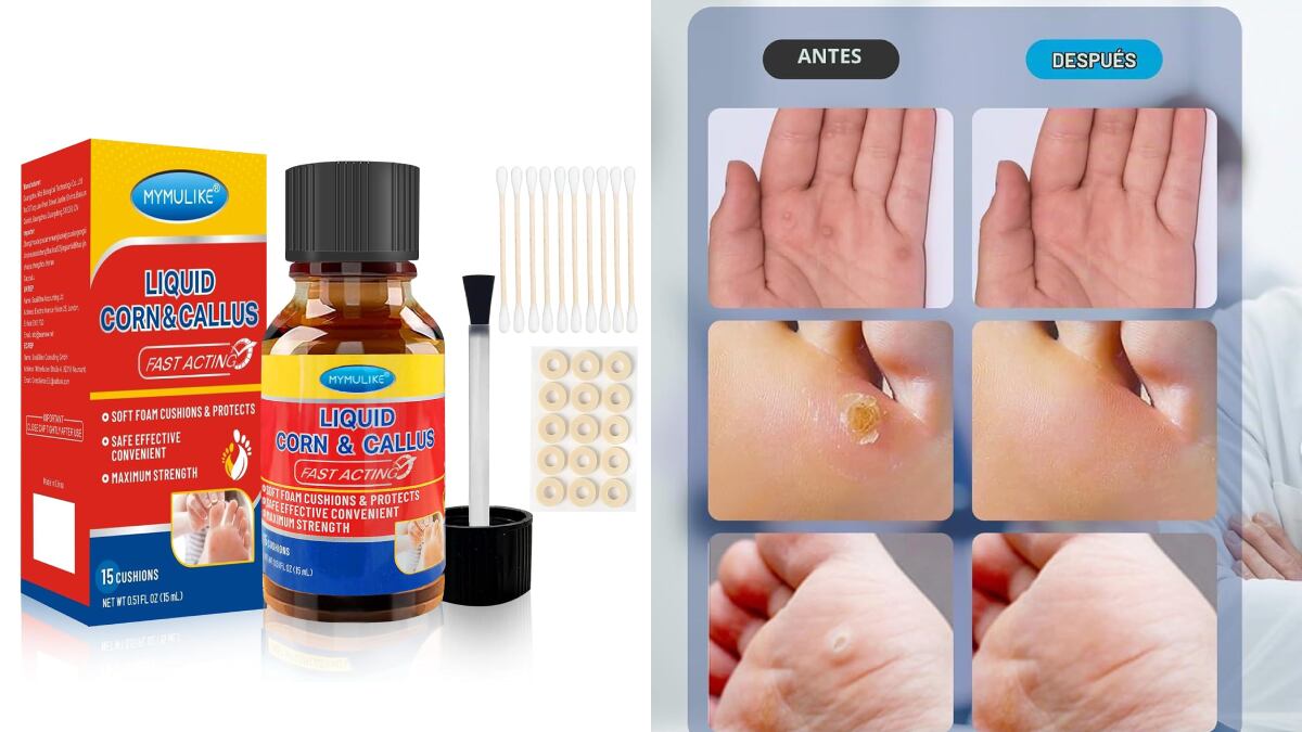 Su recipiente contiene 15 ml de capacidad.