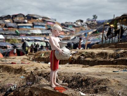 El más rubio de los rohingyas