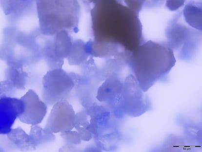 Partículas de lapislázuli aisladas del sarro dental de la monja.