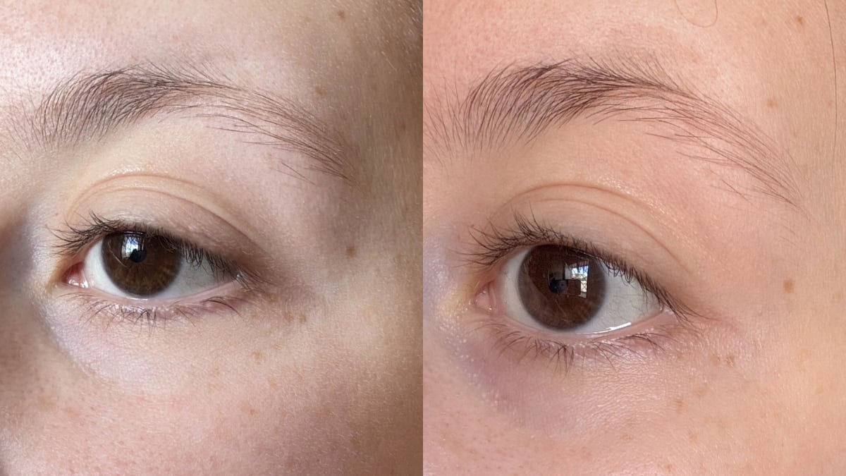 Mis ojos antes y después de probar los lluminating blue eye masks de Grace & Stella.