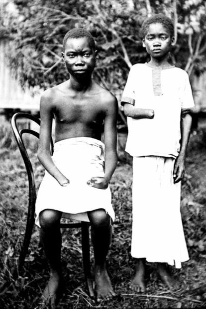 Mola y Yoka, que perdieron las manos por torturas de los soldados en el Congo de Leopoldo II alrededor de 1900.