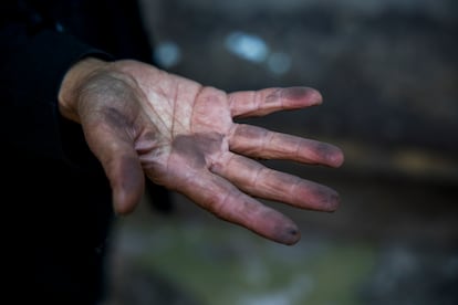 Pilar Hevia, vecina de la zona, muestra su mano negra tras tocar el polvo que se deposita en sus casas. 