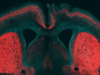 C&oacute;rtex cerebral de rat&oacute;n con el gen humano activo en el hemisferio derecho.