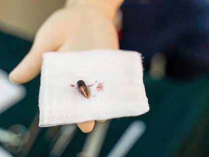 Una bala extraída de un paciente atendido en el hospital de Bashair, Jartum, en mayo de 2023.
