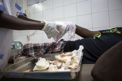 La enfermera Dienaba Tamba trata a Diouf, un paciente que no sabía que era diabético hasta que acudió al hospital. Aquí le someten a una cura en sus extremidades, las partes más afectadas.
