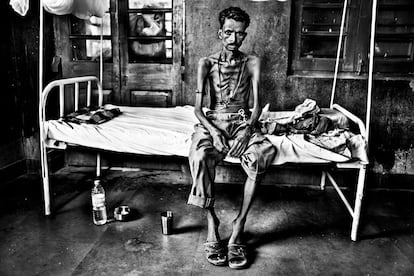 Serie 'Kala azar, fiebre negra'. Abedab padece desnutrición y leishmaniasis y lleva cinco días ingresado. Sin el tratamiento gratuito que le ofrecen en este hospital este agricultor, que apenas gana dinero para alimentar a sus 5 hijos, hubiera muerto hace días.
