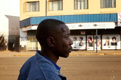 Un hombre con una lesión en la cabeza a causa de los golpes por los soldados zimbabuenses en las calles de Harare, el 1 de agosto de 2018, después de que estallaran las protestas por presunto fraude en las elecciones del país.