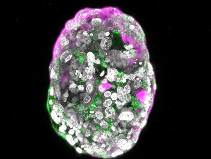 Modelo de embrión humano de 8 días, creado por el laboratorio del científico palestino Jacob Hanna, del Instituto Weizmann de Ciencias