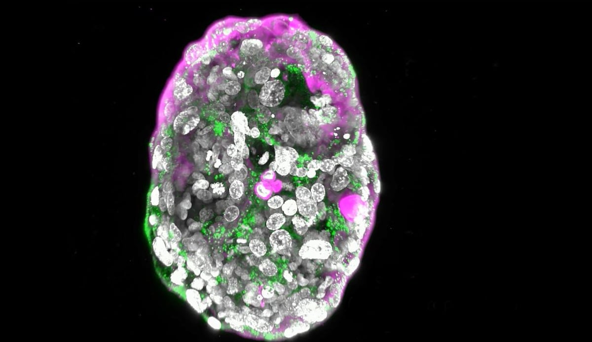 New 14-day embryo model sheds light on the biggest enigma of human