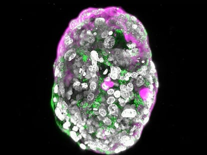 Modelo de embrión humano de 8 días, creado por el laboratorio del científico palestino Jacob Hanna, del Instituto Weizmann de Ciencias