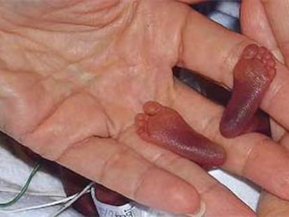 Los pies de la niña, que medía 24.13 centímetros y pesaba 284 gramos.