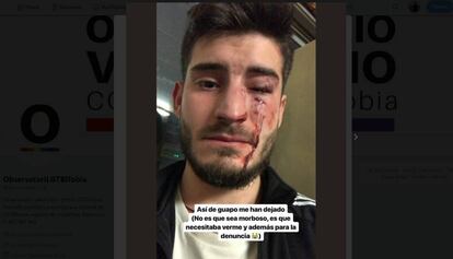 Foto de la víctima en Twitter que mostra les lesionis producte de l'agressió.