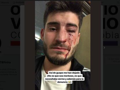 Foto de la víctima en Twitter que mostra les lesionis producte de l'agressió.