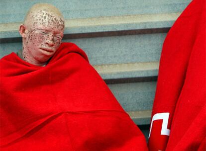 Moszy, el joven albino, tras su llegada a Tenerife el pasado día 29.