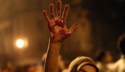 Un manifestante muestra su mano manchada de sangre en El Cairo.