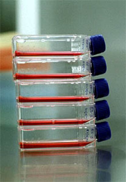 Células madre embrionarias en botellas de laboratorio.