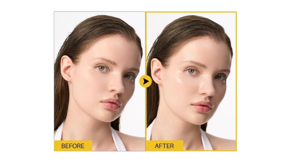 Antes (before) y después (after) de su aplicación.