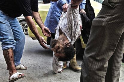 Llegada de un herido a un hospital de Alepo, en 2012.