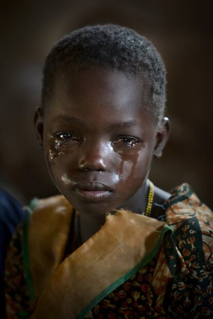 Qussi, de 10 años, llora tras conocer que, como su hermana, ha dado positivo en el test de la Enfermedad del Sueño, en la aldea de Kamasso Bolo, República Centroafricana.