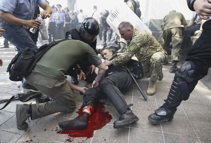 Un oficial de policía es atendido tras ser herido en la pierna durante los enfrentamientos ante el Parlamento de Kiev (Ucrania).