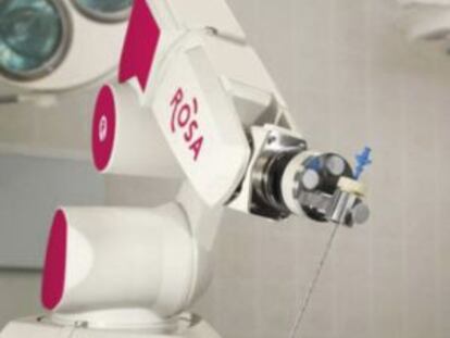 Robot que permite operar epilepsias sin tratamiento.