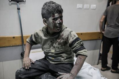 Un niño palestino herido durante un ataque israelí es tratado en el hospital Nasser, este lunes en Jan Yunis.