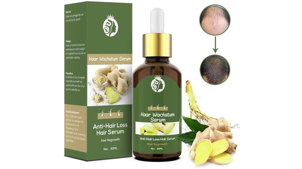 Caída de pelo: 15 productos que ayudan a combatir la alopecia ...