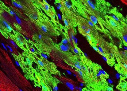 El implante de células humanas (en verde) contiene haces fibrilares y sarcómeros bien formados; células del huésped macaco en rojo.