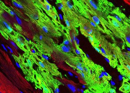 El implante de c&eacute;lulas humanas (en verde) contiene haces fibrilares y sarc&oacute;meros bien formados; c&eacute;lulas del hu&eacute;sped macaco en rojo.