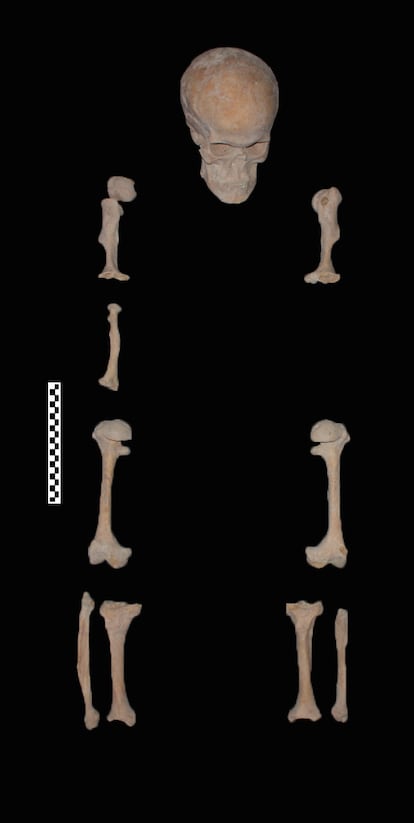 Huesos del esqueleto.