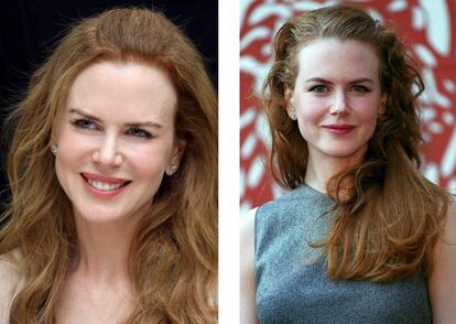 Nicole Kidman se ha sometido a tratamiento con botox y ha pasado por el quirófano. Ella misma lo ha contado.