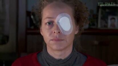 Ester Quintana, 42 años, perdió un ojo el 14-N tras una manifestación.