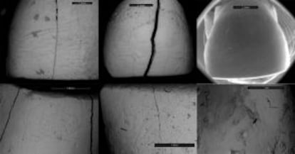 A microscopic view of dental striation.