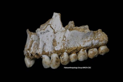 Mandíbula del neandertal de El Sidrón con restos de corteza de álamo.