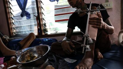 Sein Win, nombre ficticio, sufrió heridas en una pierna durante un combate contra el ejército de Myanmar. En la imagen, está sentado en una cama de un centro de rehabilitación clandestino para combatientes de la oposición en la frontera con Tailandia.
