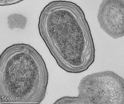 Electron microscope view of 'Prochlorococcus' cells.