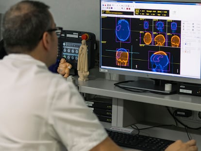 Un tcnico supervisa el escner de una paciente con un tumor cerebral antes de empezar una sesin de protonterapia.