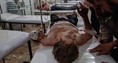 Dos hombres tratan de comunicarse con un herido en un hospital improvisado de Duma, a las afueras de Damasco, el pasado 26 de septiembre.