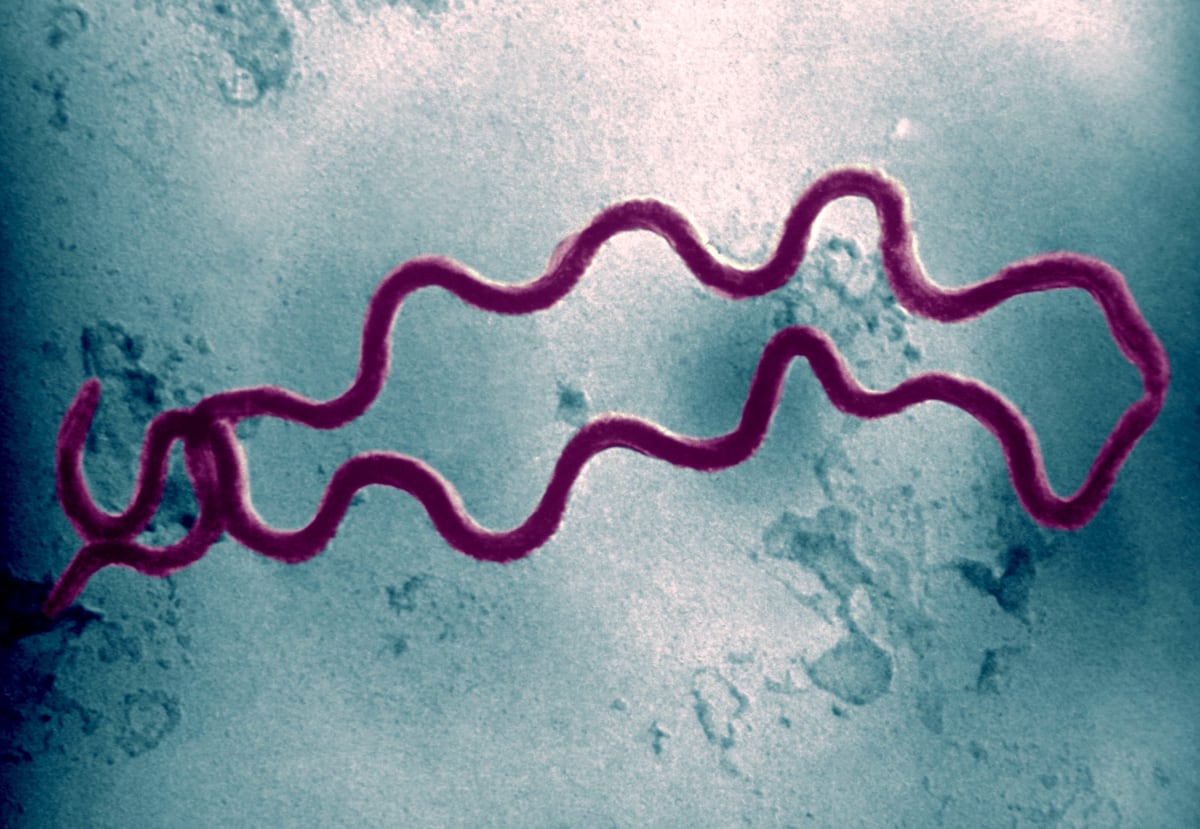 El aumento de las infecciones de transmisión sexual también golpea a los recién nacidos, con dos fallecidos por sífilis congénita