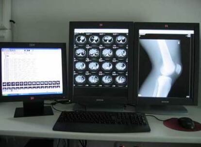 La digitalización de las imágenes ha impulsado el desarrollo de la telemedicina.