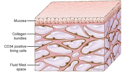 Recriação artística das cavidades do interstício sob a pele.