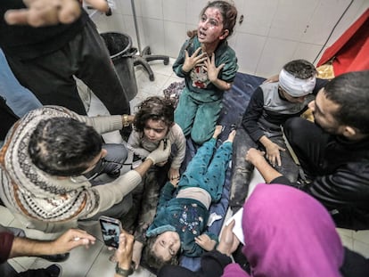 Niños heridos este jueves, tras un bombardeo israelí en Jan Yunis (Gaza).